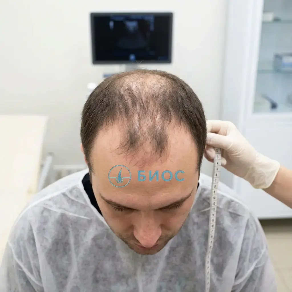 До пересадки: пациент 36 лет